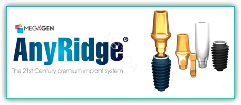 anyridge