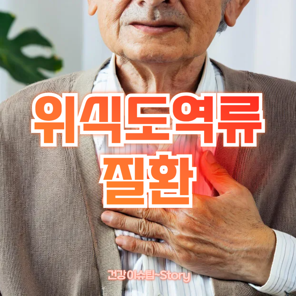 위식도역류 질환