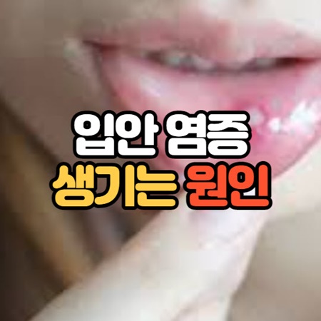 입안 염증이 생기는 이유