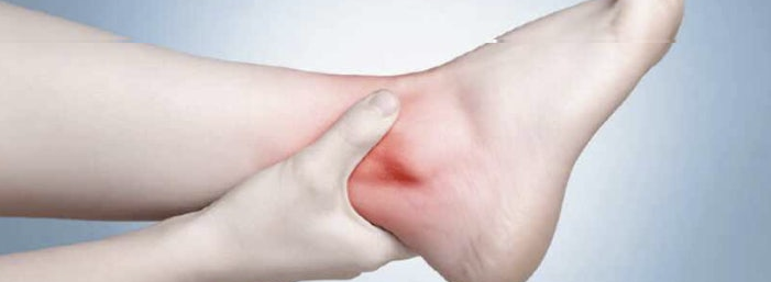 복숭아뼈 물혹3