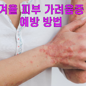 겨울철 피부 가려움증