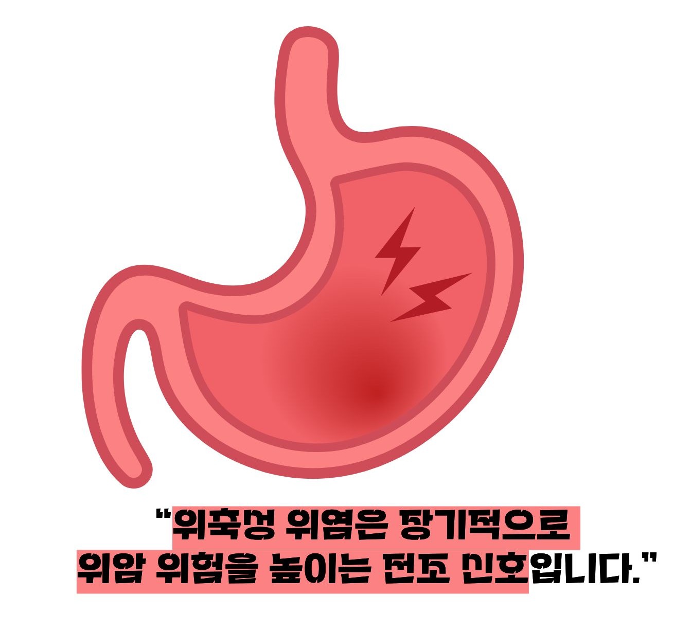 위축성 위염에 걸리는 증상