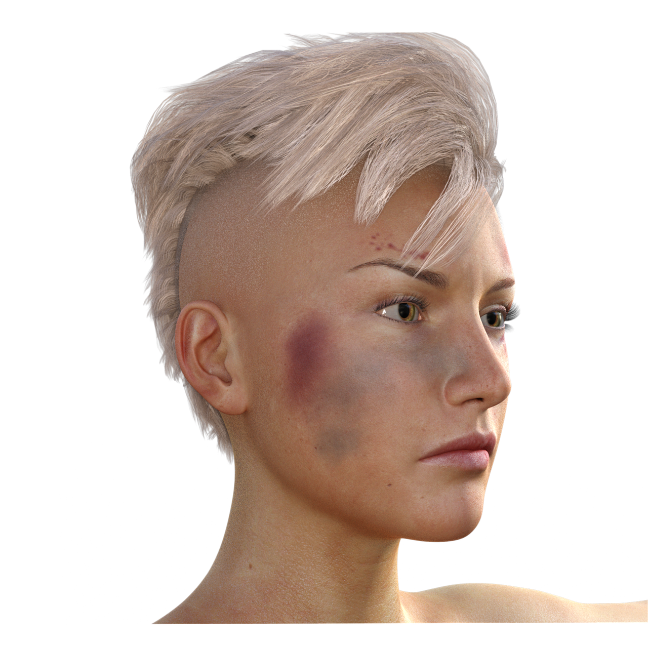 멍빨리 빼는법: 빠르게 멍을 가라앉히는 효과적인 방법