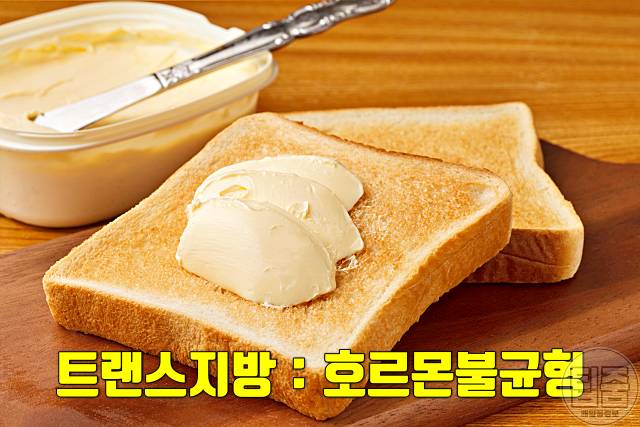 여자 인중 수염 없애는법 제모 없이 트랜스지방