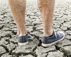 하지정맥류 증상 수술비용 좋은운동 등 총정리(2024 최신)