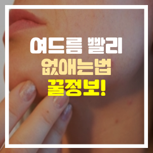 여드름 빨리 없애는법