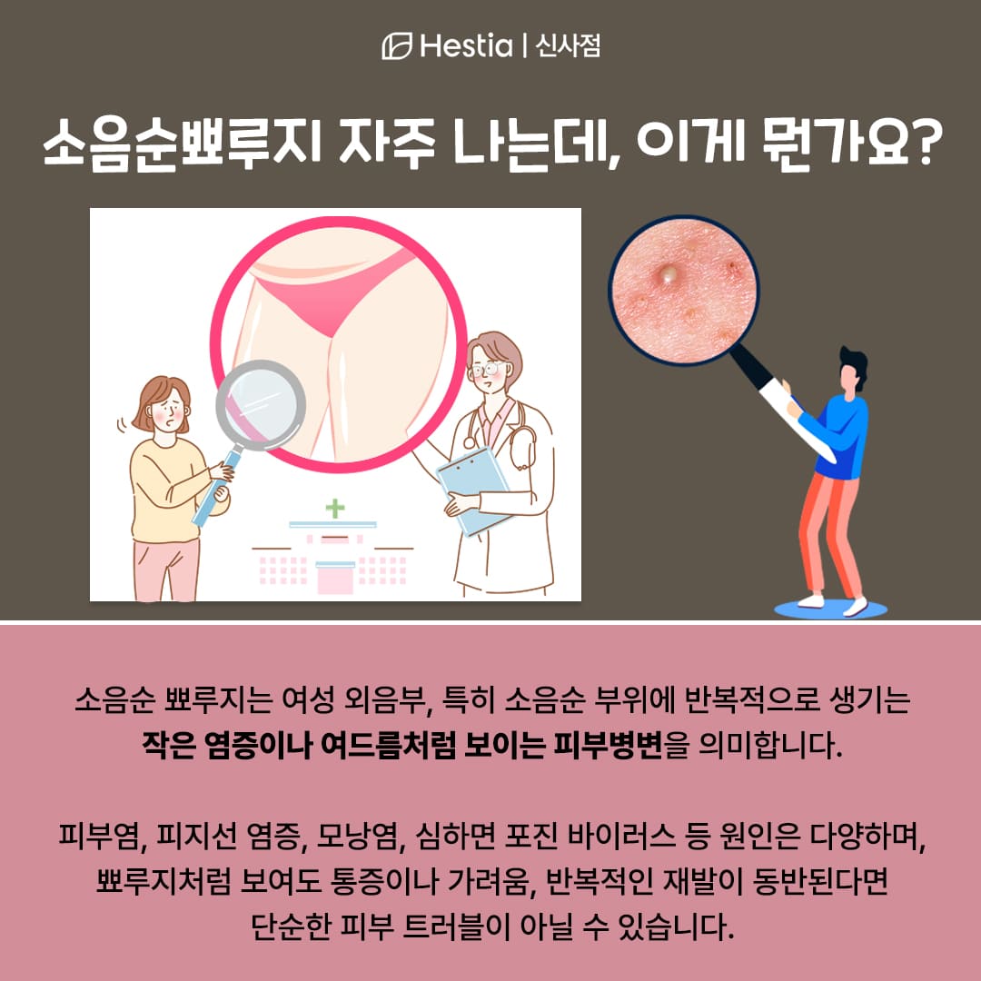 자꾸 생기는 소음순뾰루지, 원인이 뭘까요?