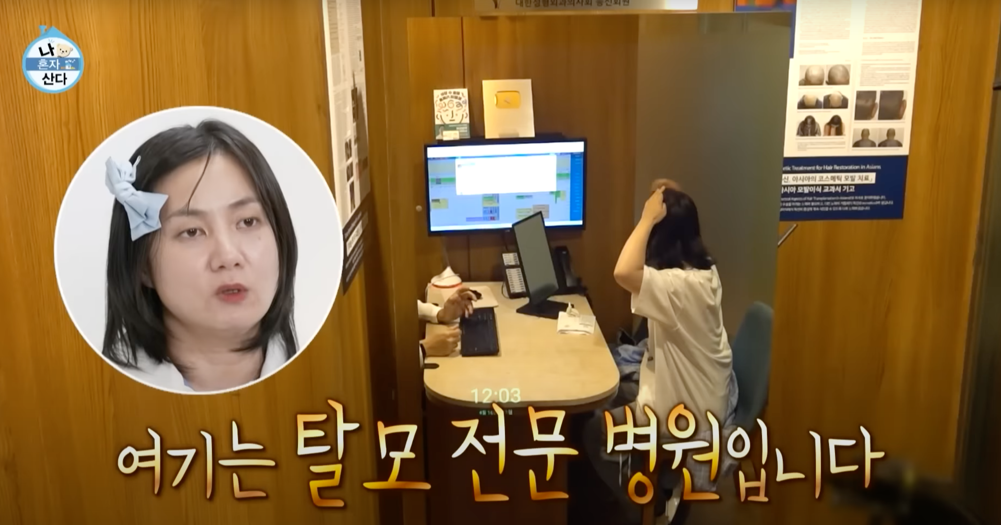 박나래탈모 나혼자산다 MBC