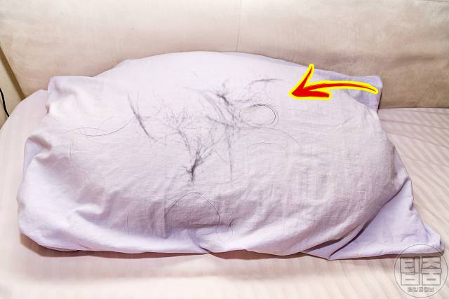 여자 탈모 자가진단 탈모초기증상 베개