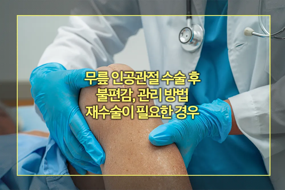 무릎 인공관절 수술 후 불편감 관리 방법 재수술 필요한 경우