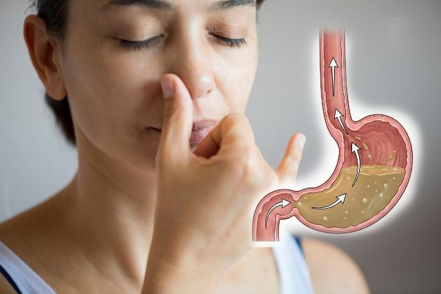 위산 역류 증상 코막힘