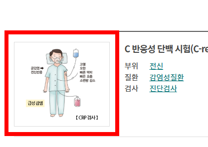 신장 검사방법 알아보기