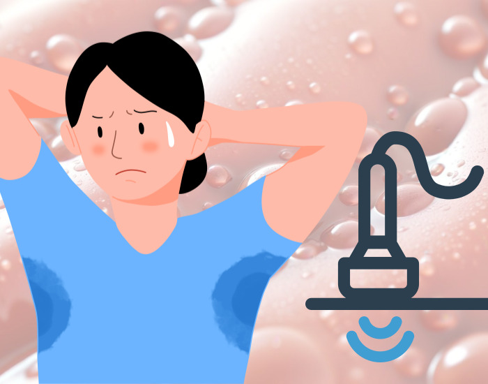 겨드랑이 다한증 레이저치료