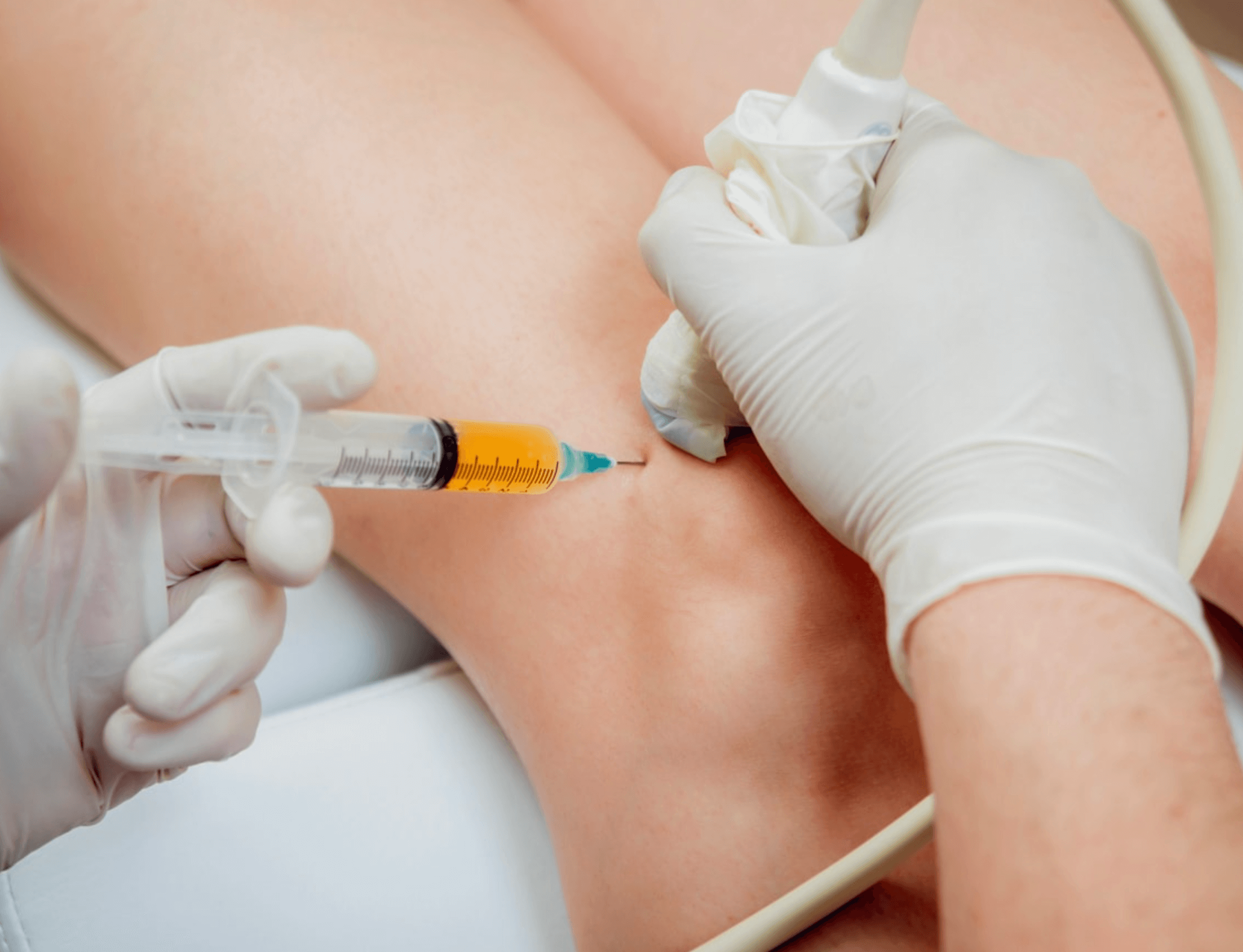 종근당-이모튼캡슐