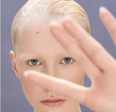 말라리아 증상 31