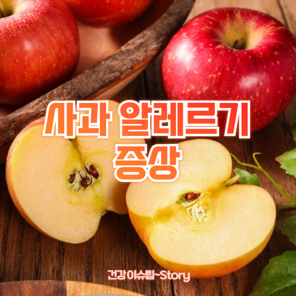 사과 알레르기 증상