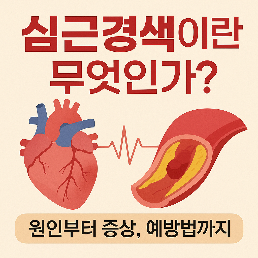 심근경색이란? 원인부터 증상, 예방법