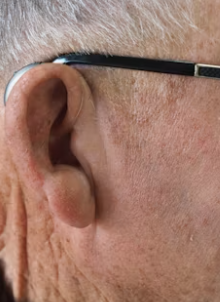 대상포진 예방접종 가격