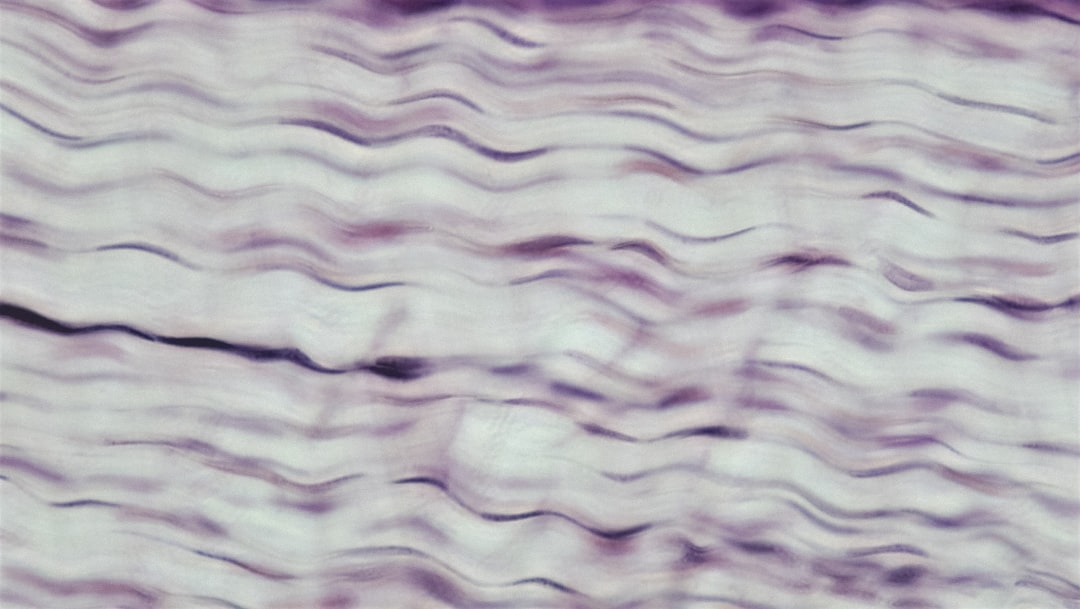 Tissue