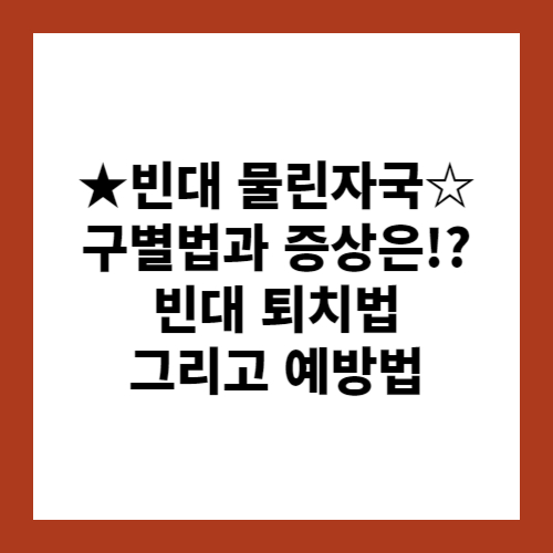 빈대 물린자국 : 빈대 퇴치법, 증상, 예방법