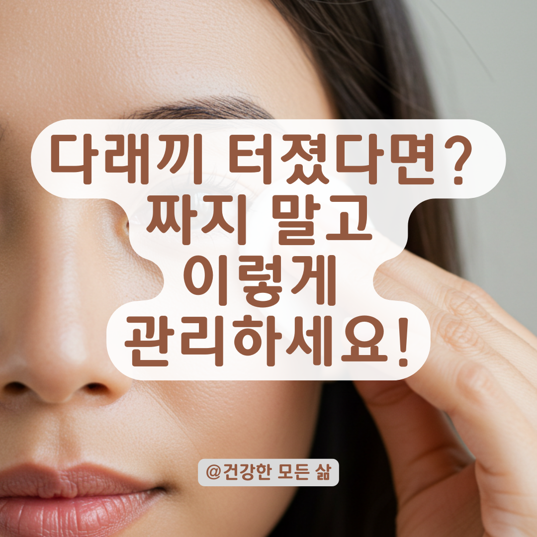 다래끼가 갑자기 터졌다면? 꼭 해야 할 위생 관리와 주의사항 총정리.