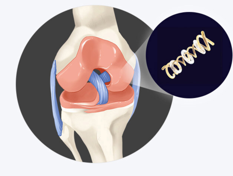콘드로이친 효능 퇴행성 해결