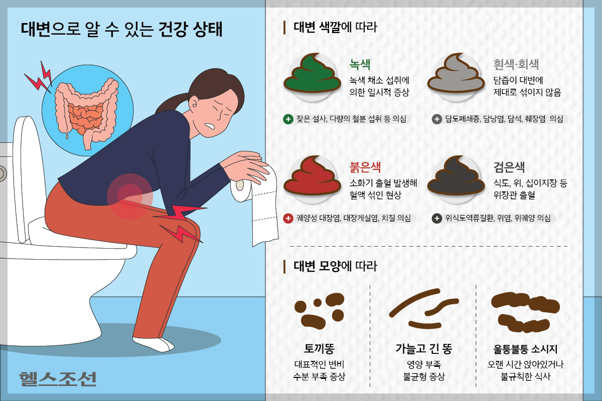 변색깔(출처 헬스조선)