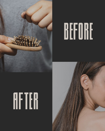 탈모떄 머리카락이 빠지고 관리후 머리숱이 풍부해짐