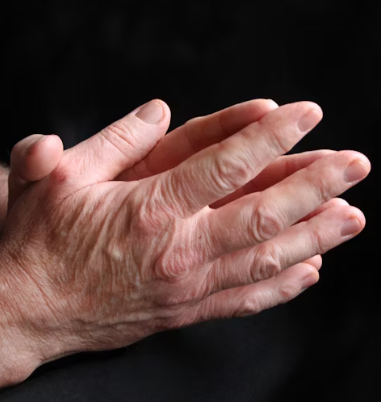 갑상선 기능 항진증 증상 원인 예방 가이드