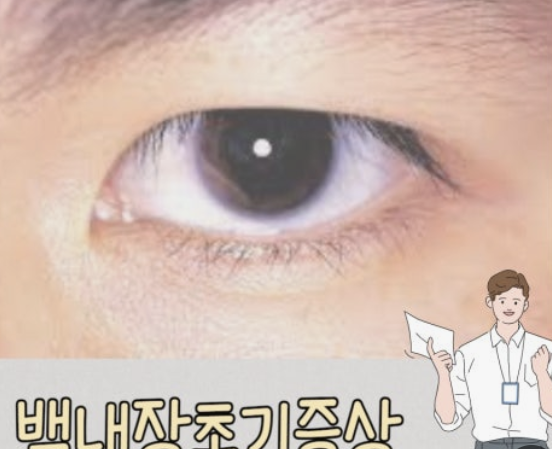 백내장 원인과 치료방법 