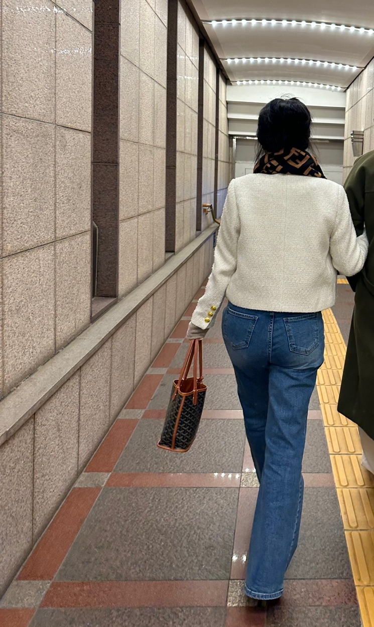 허벅지 지방흡입 후기