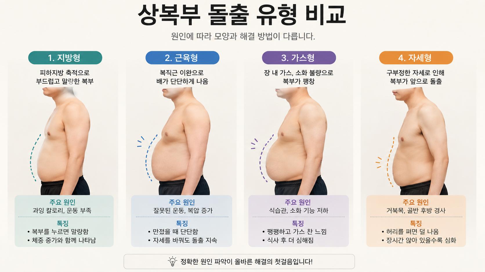윗배만 볼록 나온다면,단순 살이 아닐 수 있습니다.