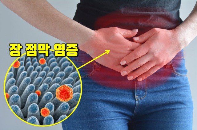식중독 증상,장염 음식