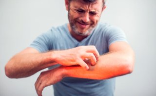 대상포진 자가관리법