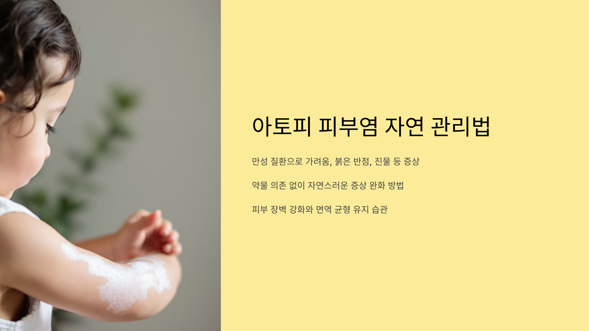 아토피 피부염