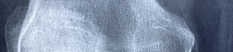 콘드로이친 효능 이미지