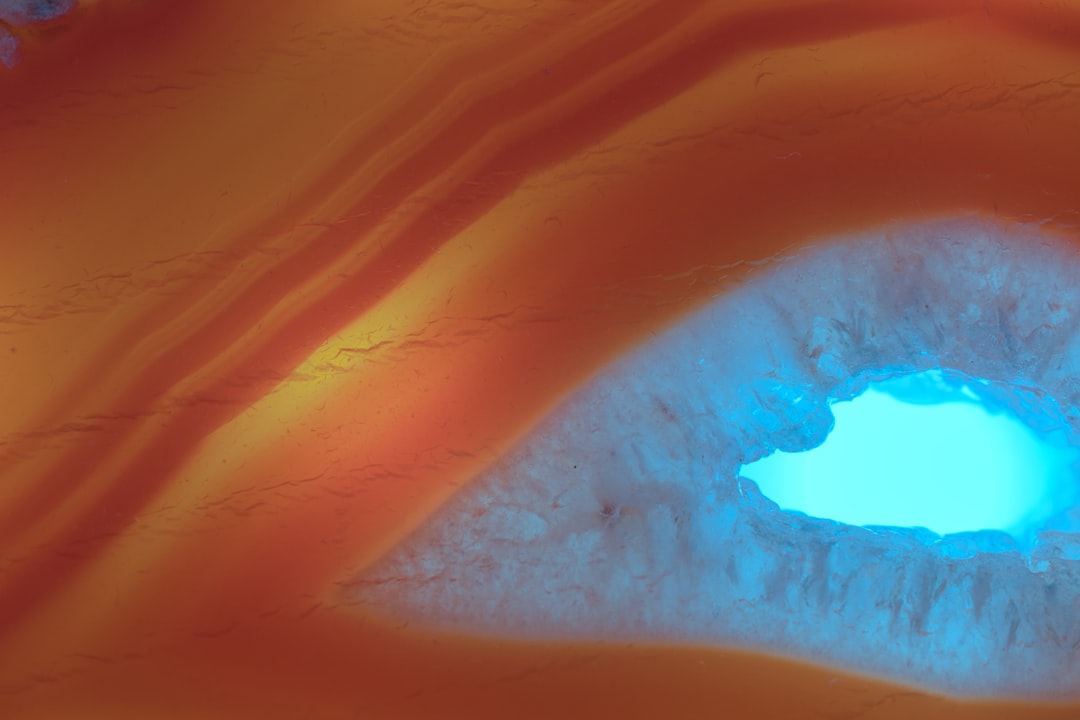 Cataract