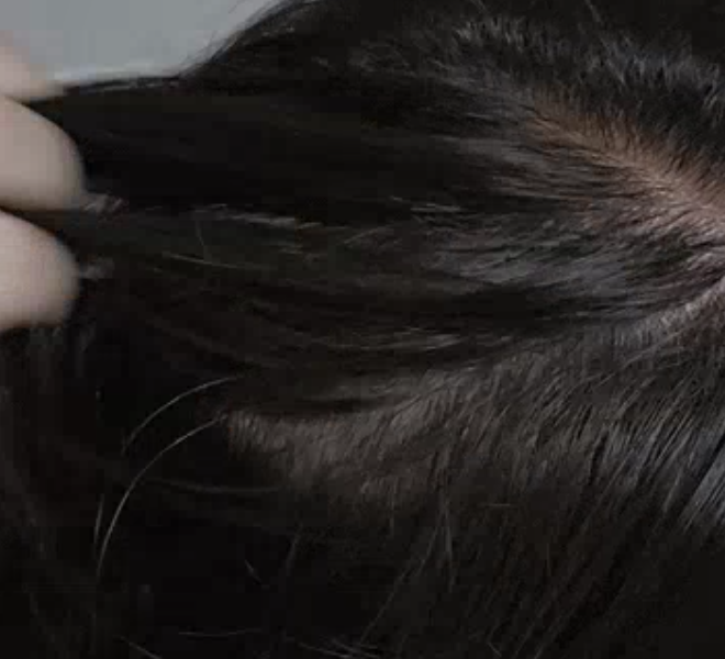 염색 후 집에서 다시 확인한 깔끔한 두피 상태와 균일한 모발 색상