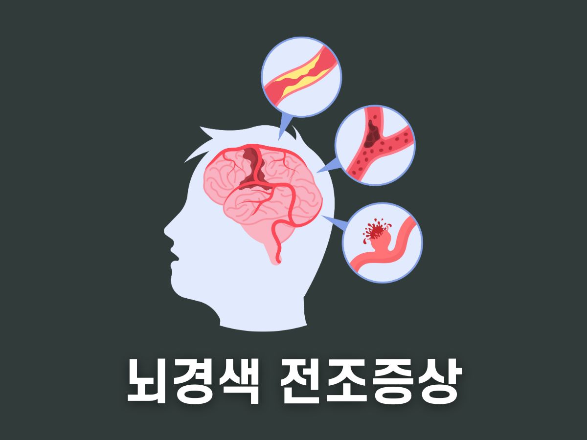 뇌경색 전조증상 체크리스트