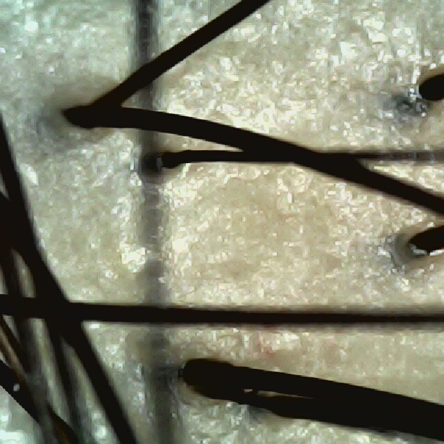 탈모 극복 프로젝트 - 정수리 두피 모습이다.