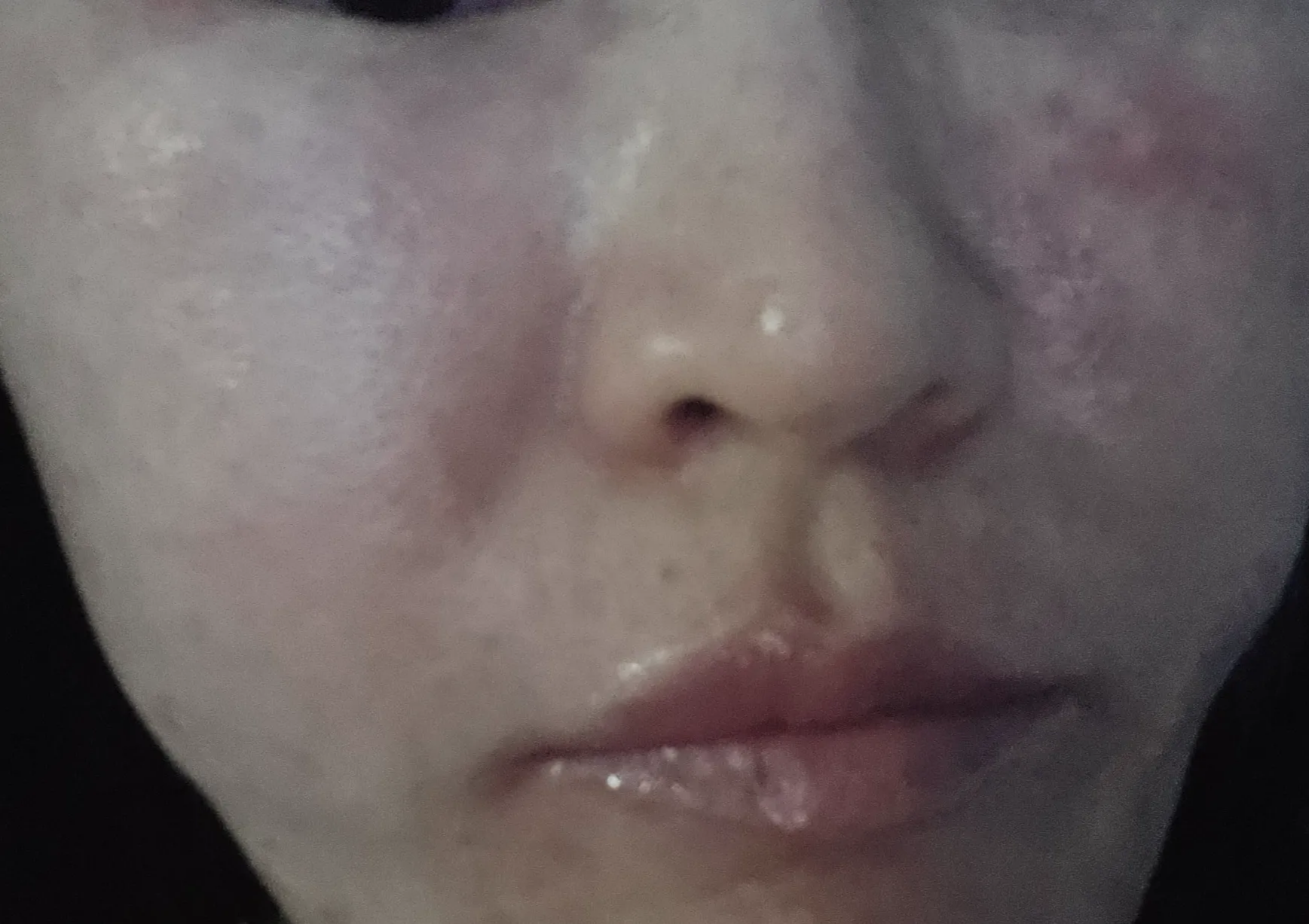 계속된 화장품 바꾸기로 민감 피부 상태를 표현한 모습