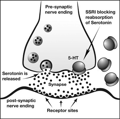 뉴프람정5MG 세로토닌 재흡수 억제제(SSRI)