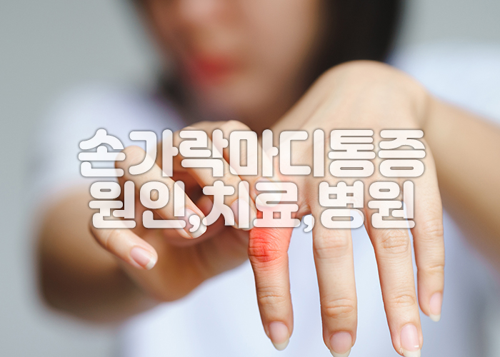 여성이 아픈 손가락 마디부위를 잡고 있다