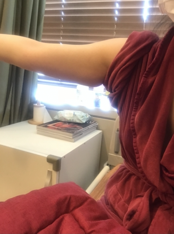 팔뚝지방흡입 후기