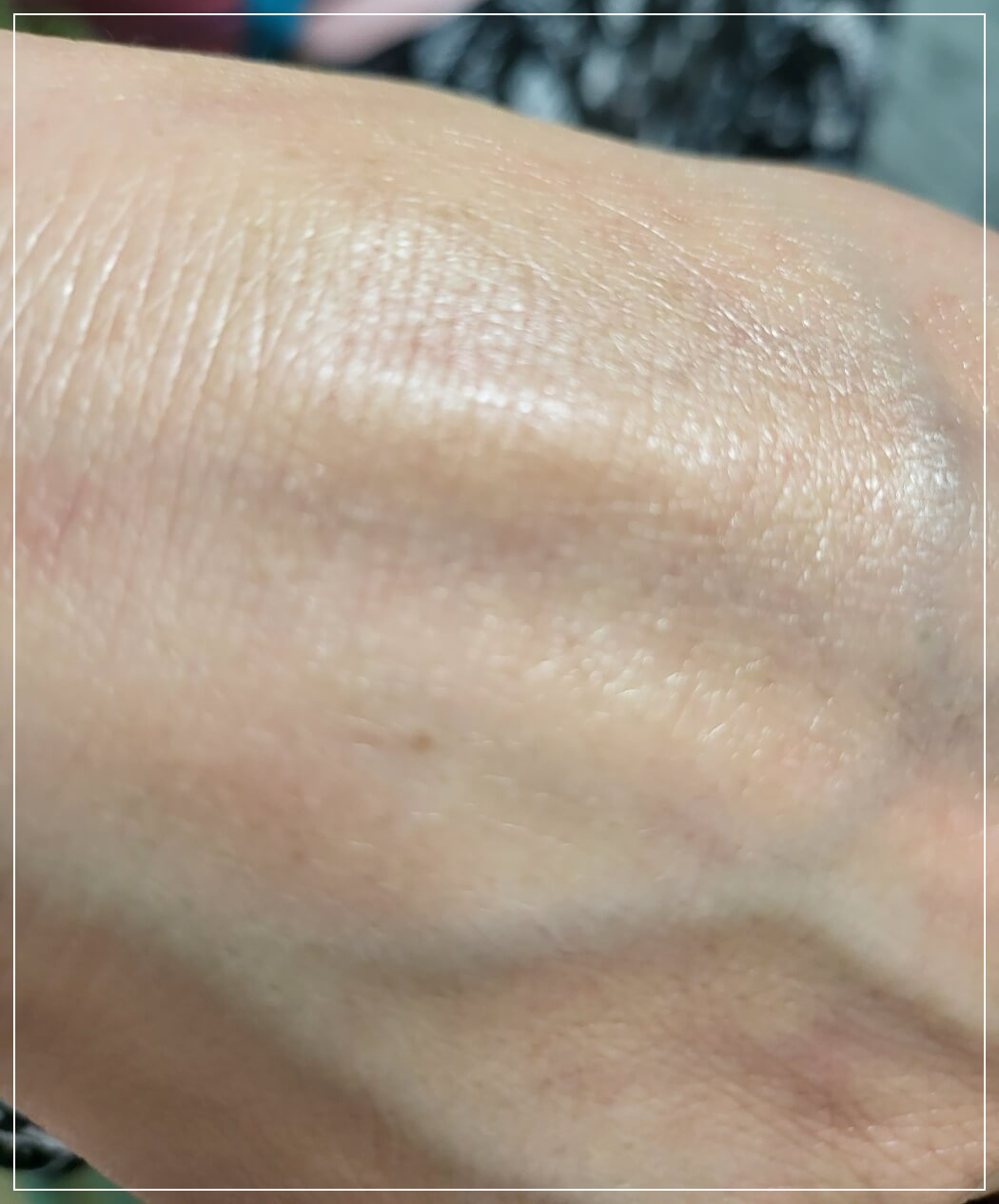 AHC 온리 포 맨 올인원 에센스 바른 후 피부상태