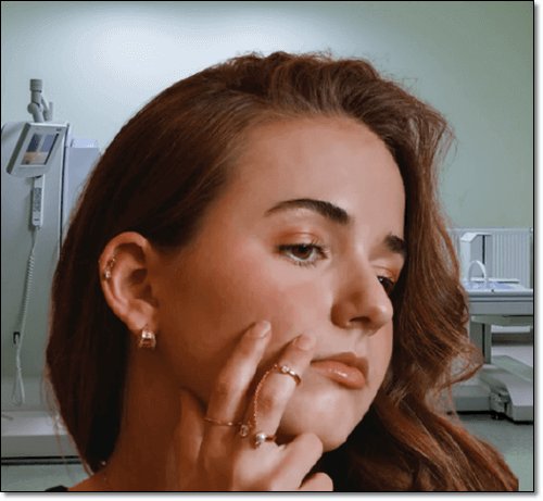 피지낭종이 생긴 여성