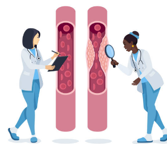 고지혈증 증상&amp;#44; 고지혈증에 좋은 음식&amp;#44; 고지혈증 수치 총정리 (2024ver)