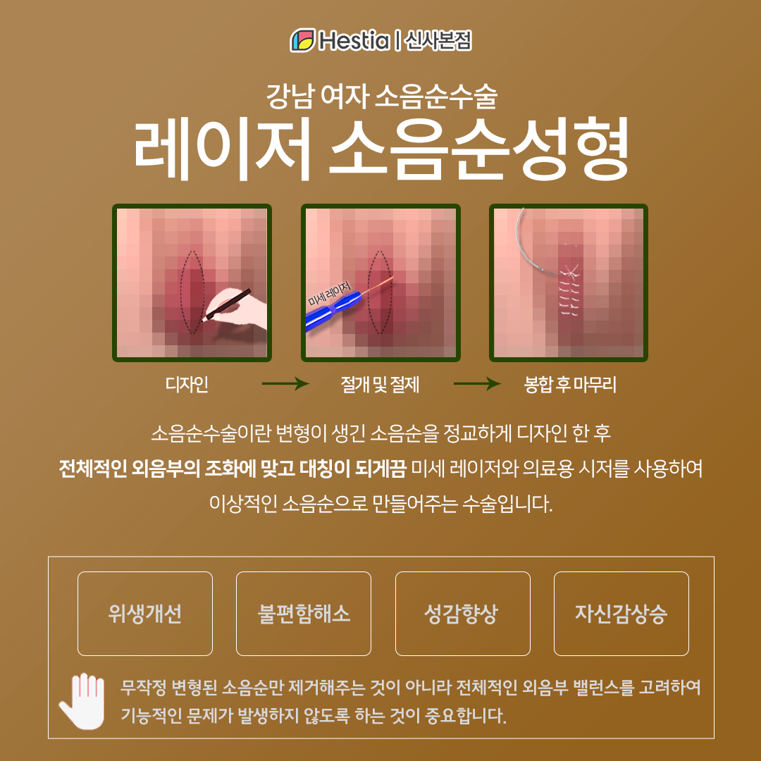 소음순성형수술 어떤 효과가 있나요?