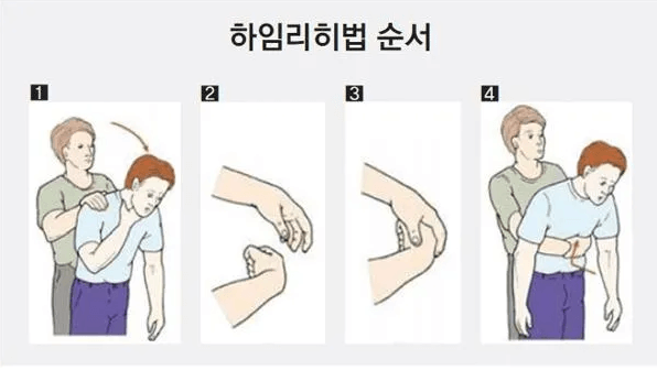 하임리히법