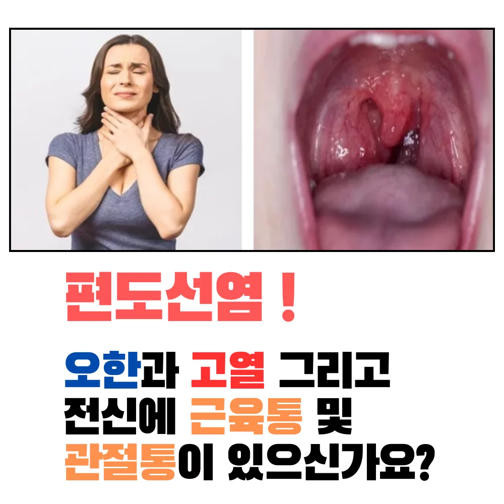 편도염-증상-오한-고열-몸살